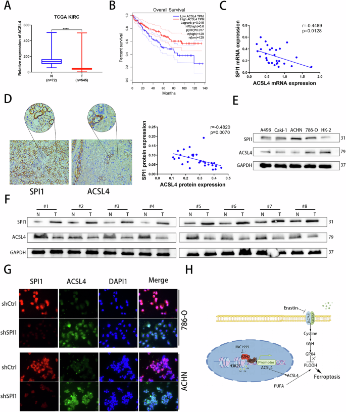 Fig. 8: ACSL4 is correlated with SPI1 in ccRCC tissue samples.