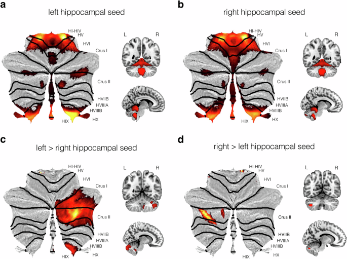 Mapping hippocampal-cerebellar functional connectivity across the human ...