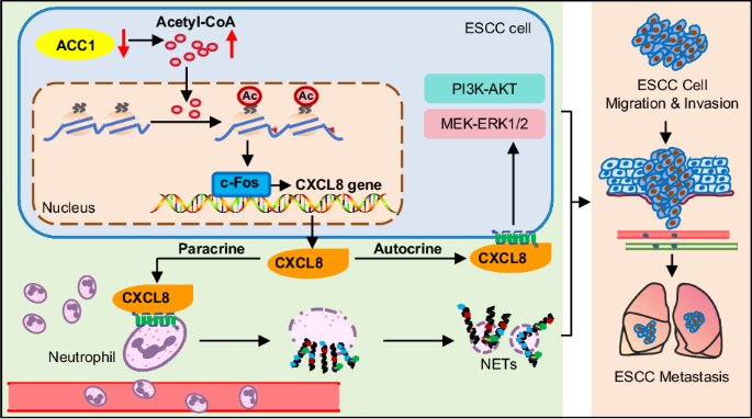 Acetyl-CoA carboxylase 1 knockdown promotes esophageal squamous cell ...