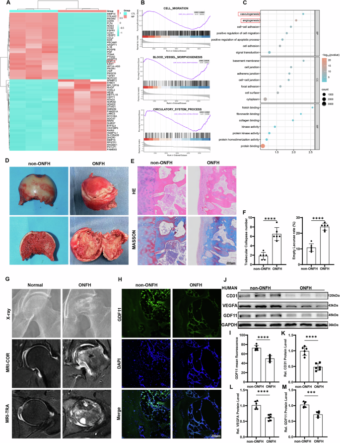 Fig. 1: GDF11 plays a key role in GC-induced ONFH.