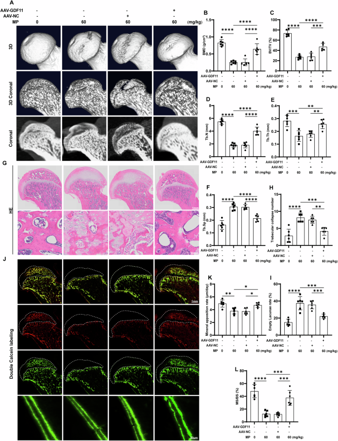 Fig. 3: GDF11 attenuates GC-induced bone destruction and maintain femoral head morphology in vivo.