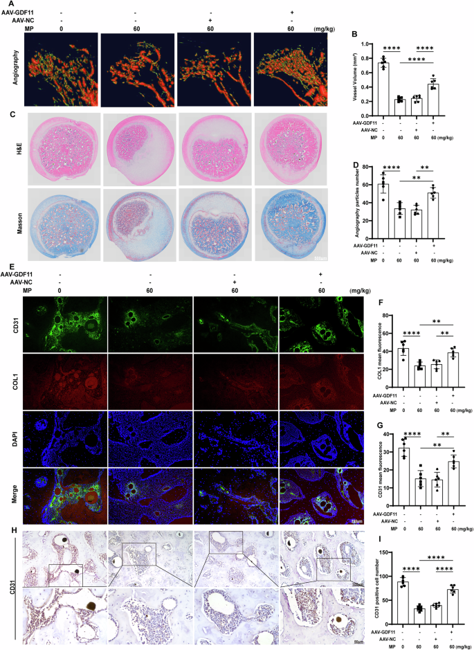 Fig. 4: GDF11 alleviates GC-induced ONFH by promoting angiogenesis.