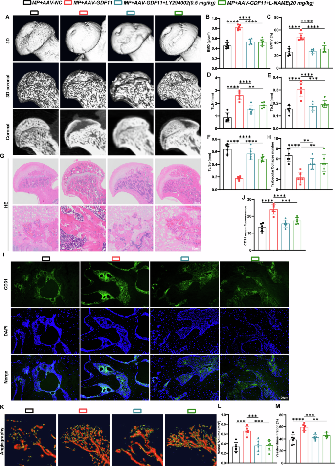Fig. 7: GDF11 exerts pro-angiogenic effects through the PI3K-AKT-eNOS signaling pathway in vivo.