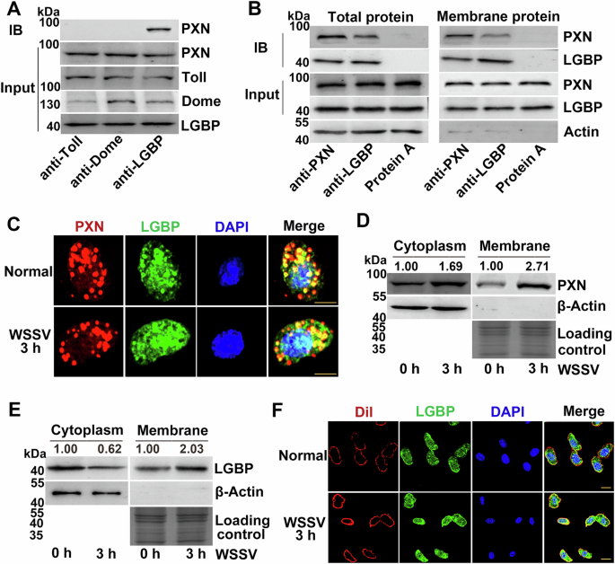 Fig. 3: Interaction between LGBP and PXN.