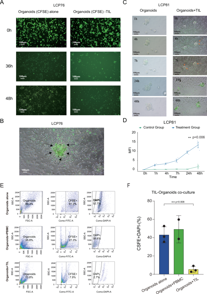 Fig. 3: Expanded TILs mediate potent and specific cytotoxicity against autologous NSCLC organoids.