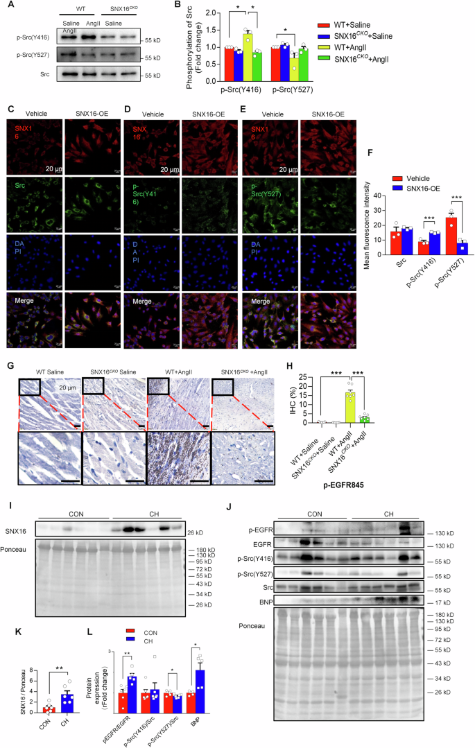 Fig. 6: Cardiac specific deletion of SNX16 inhibited the Src-EGFR signaling pathway, and the expression of SNX16 and the phosphorylation of EGFR and Src were elevated in the heart tissues of patients with cardiac hypertrophy.