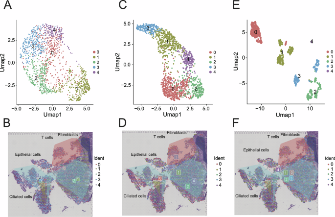 Fig. 3: Spatial analysis of m6A modifications in UCEC tissues using Scm6A and spatial transcriptomics.