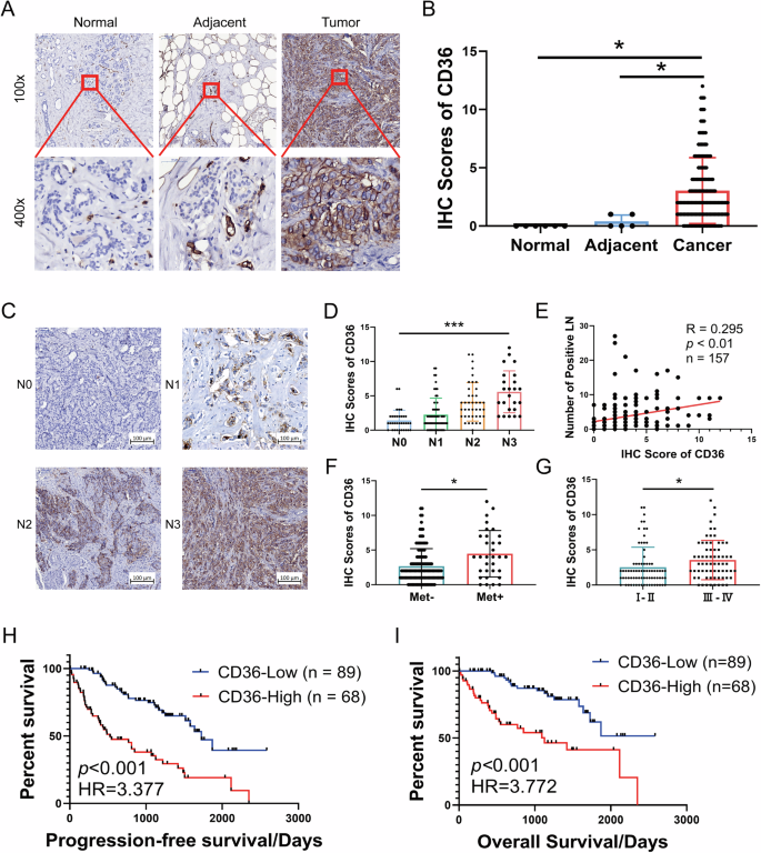 Fig. 1: CD36 is highly expressed in BC and positively correlated with N stage and poor prognosis.