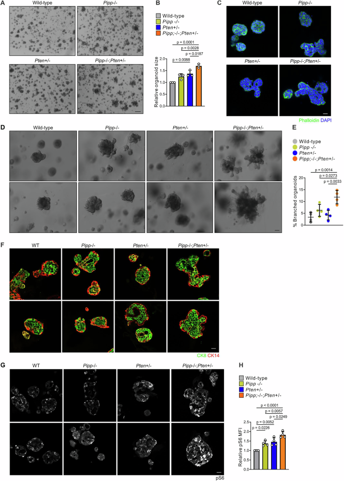 Fig. 3: Pipp ablation increases the size of Pten+/− mammary organoids.