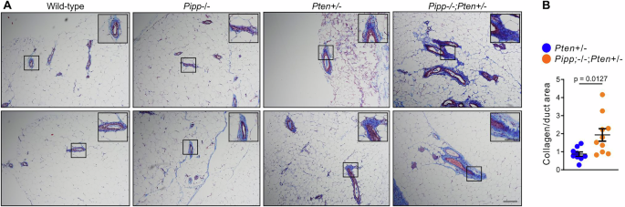 Fig. 4: Pipp ablation enhances collagen deposition in Pten+/− mammary ducts.