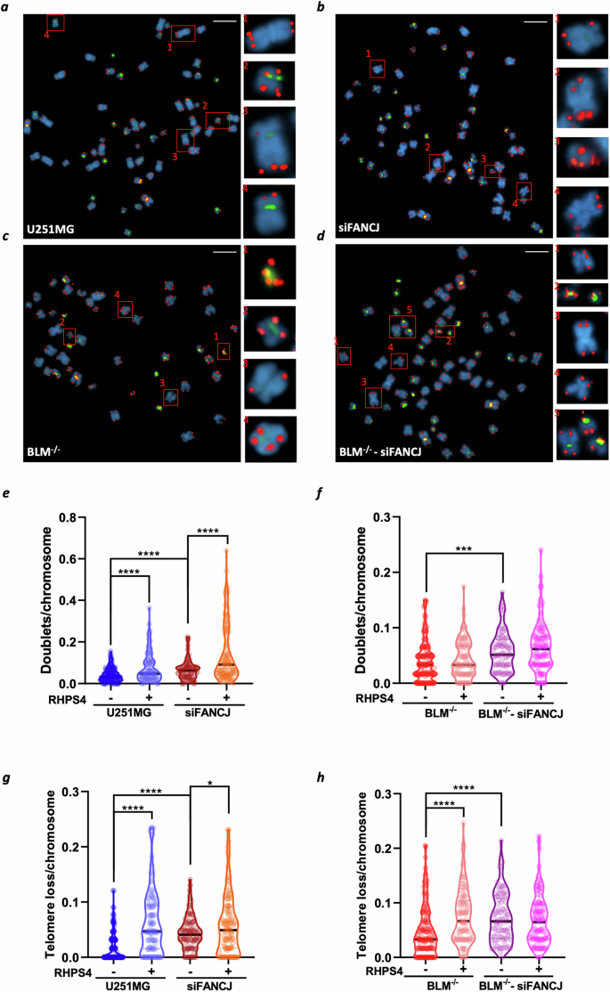 Fig. 6: FANCJ depletion induces telomere abnormalities in U251MG and BLM−/− cells following RHPS4 treatment.
