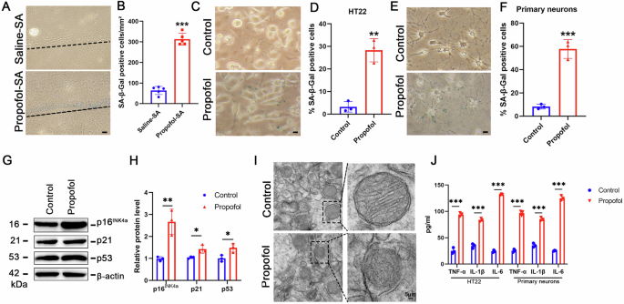 Fig. 2: Propofol induces senescence in hippocampal neurons by upregulating p16INK4a expression.