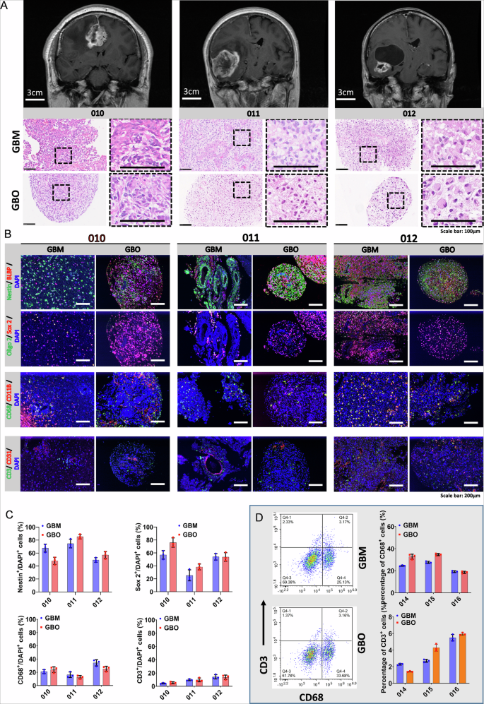 Fig. 3: Pathological evaluation of the TME in GBOs.
