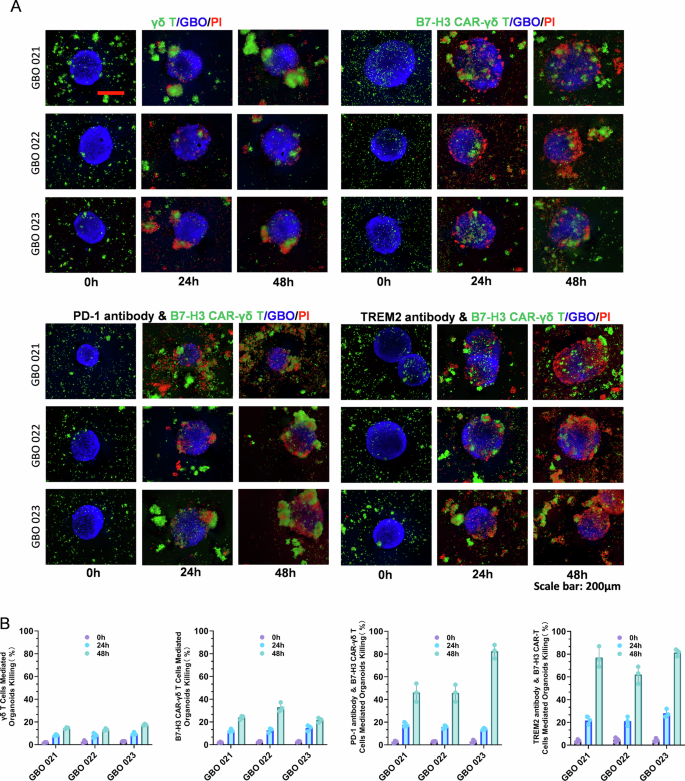 Fig. 5: Evaluation of individualized therapeutic efficacy of combined immunotherapy with B7-H3 CAR-γδ T cells.