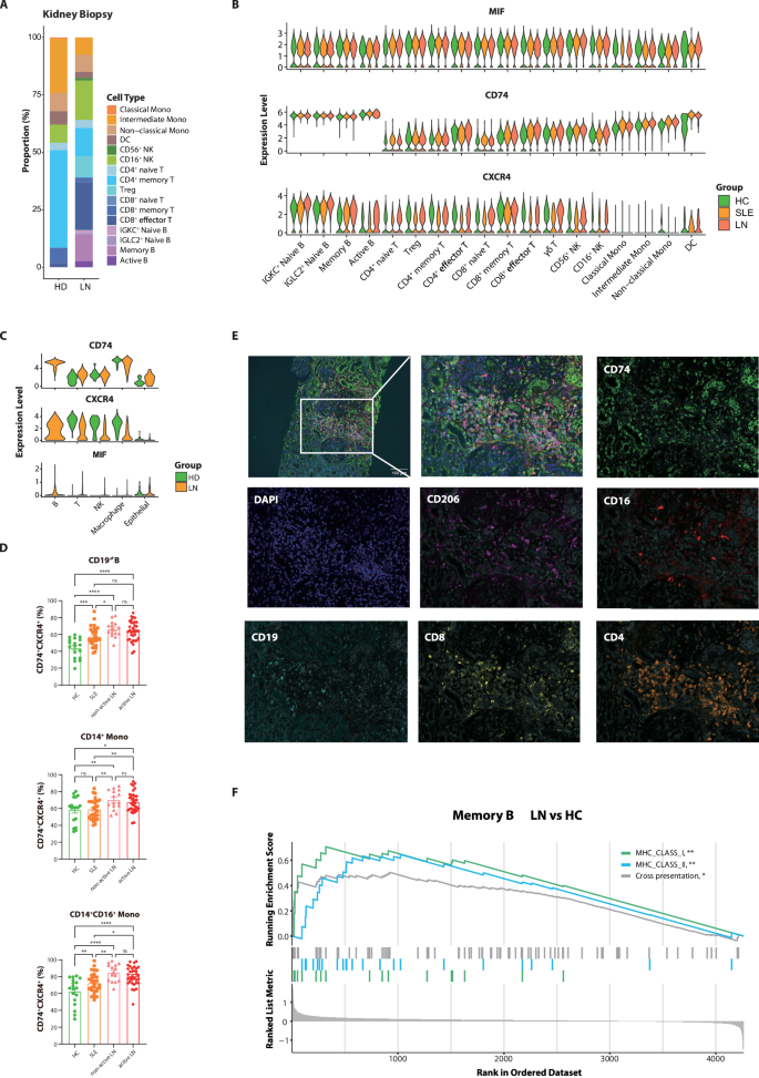 Fig. 6: Excessive activation of the macrophage migration inhibitory factor (MIF) pathway in PB and kidney tissues of LN patients.