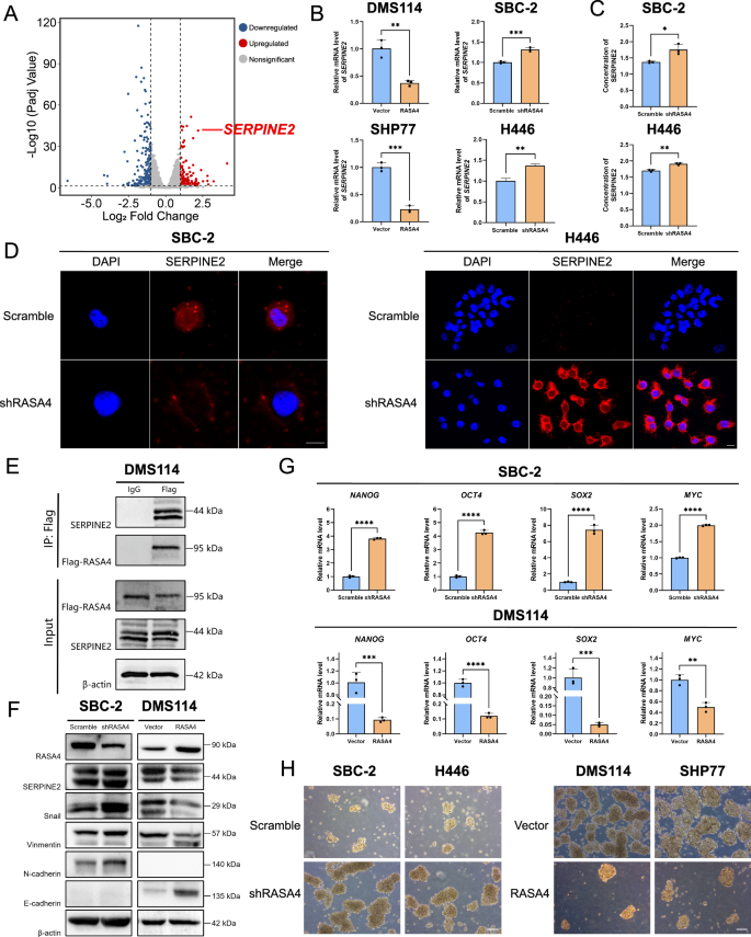 Fig. 5: RASA4 inhibits EMT and stemness in SCLC cells through the suppression of SERPINE2.