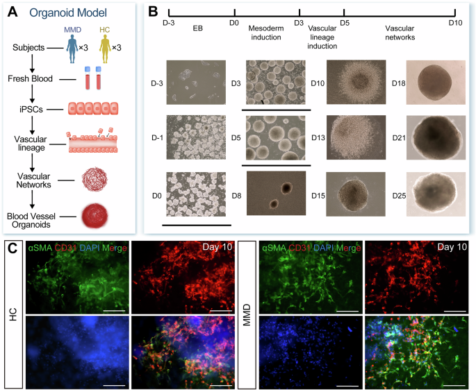 Fig. 3: Generation of the vascular organoids derived from HC individuals and MMD patients.