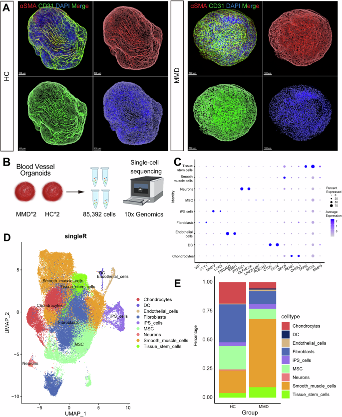 Fig. 4: Single-cell RNA sequencing indicates abnormalities in the abundance and function of VSMCs in MMD organoid.