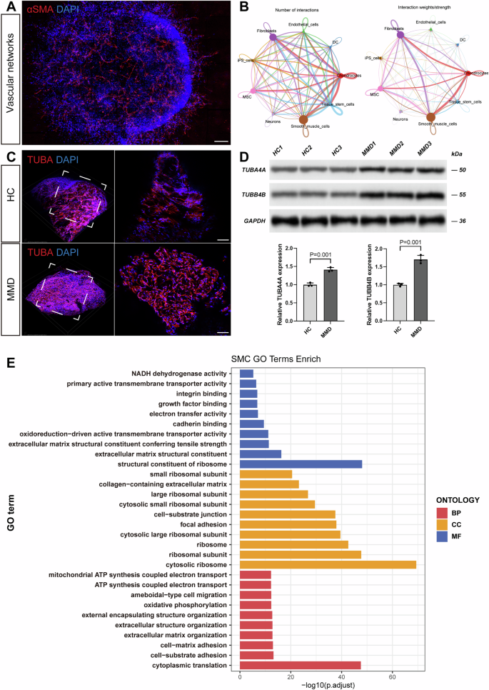 Fig. 5: MMD vascular organoids exhibit an upregulation of TUBA4A and activation of the downstream GJA1/PI3K/AKT/KLF4 pathways.