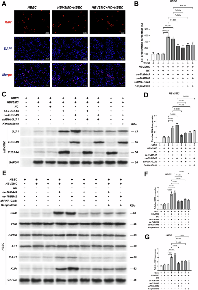 Fig. 6: TUBA4A or TUBB4B overexpressed in HBVSMCs promotes the proliferation of HBECs through the KLF4 molecule.