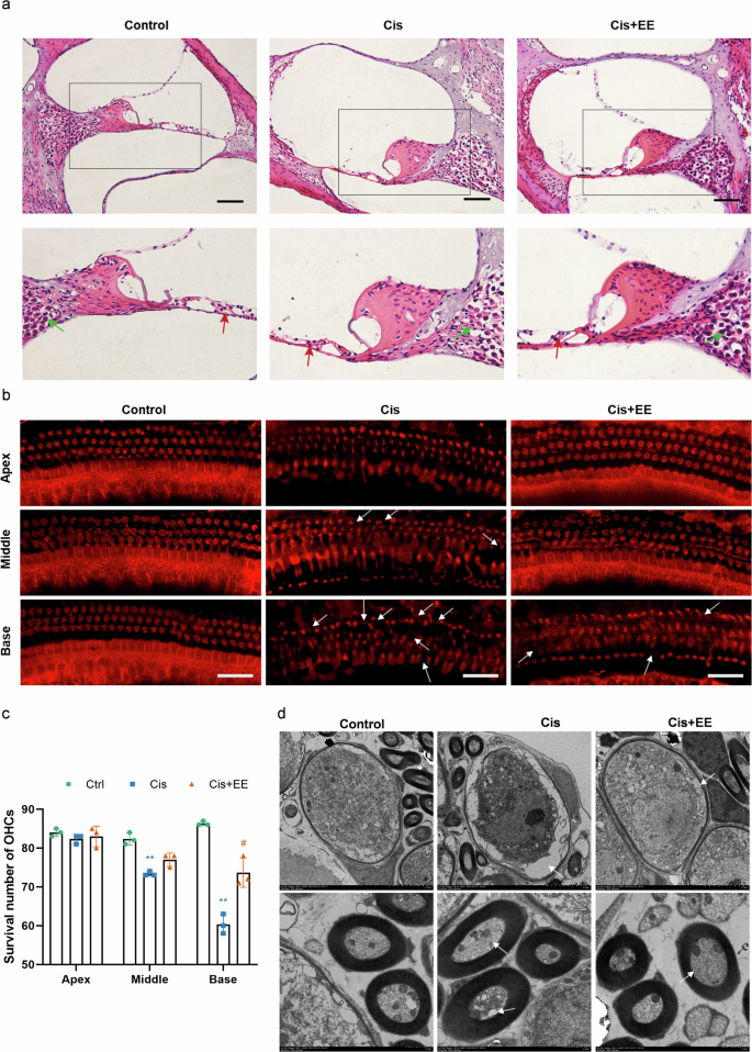 Fig. 3: EE attenuates cisplatin-induced structural damage in the cochlea.
