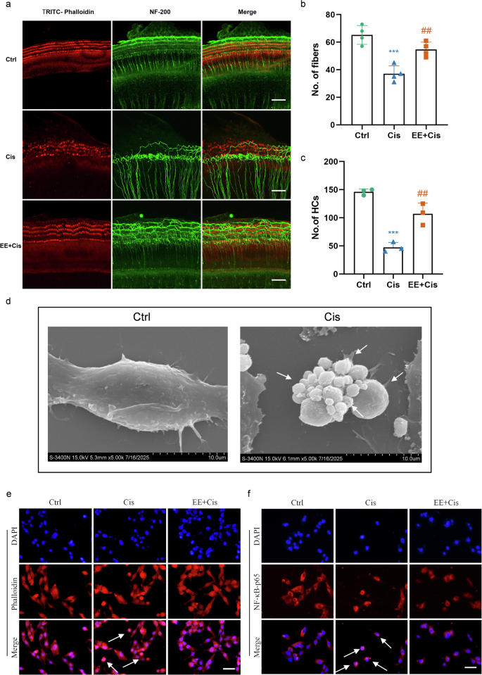 Fig. 7: EE attenuates cisplatin-induced damage in cochlear explants and HEI-OC1 cells.