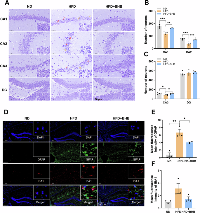 Fig. 4: BHB ameliorates HFD-induced hippocampal neuronal damage and neuroinflammation in mice.