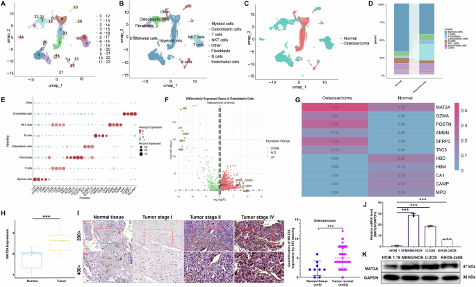 Fig. 1: High MAT2A expression correlates with osteosarcoma progression.