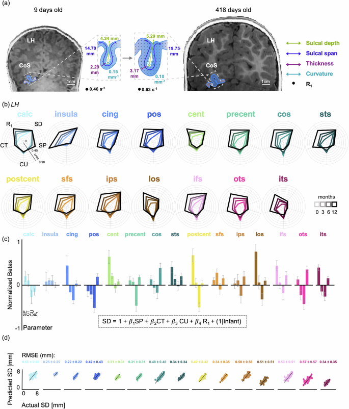 Fig. 5: SD development can be predicted by a linear combination of SP, CT, CU, and R1.