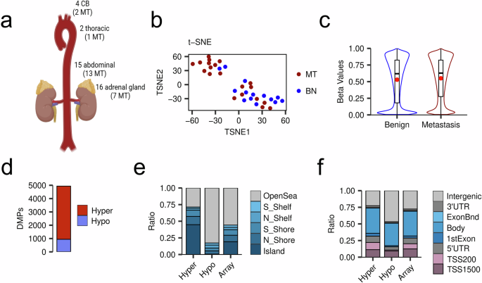 Fig. 1: Global DNA methylation profiling reveals distinct epigenetic patterns in metastatic versus benign PPGLs.