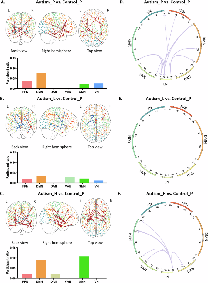 Fig. 5: Discriminative LN-related connections between the autism and control groups as measured by different PAC values.