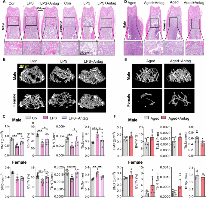 Fig. 4: PiR48444 antagomir protects LPS-induced and aging-related trabecular bone loss.