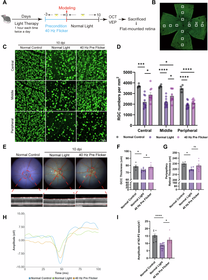 Fig. 1: 40 Hz flicker preconditioning (Pre Flicker) for 3 days before ischemia protected RGCs, reduced GCC layer atrophy, and preserved visual function in the NAION model.