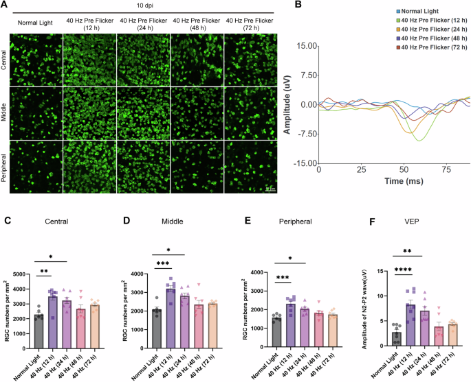 Fig. 2: 40 Hz Pre-flicker treatment administered within 24 h before NAION induction confered protection, with the 12 h interval providing the strongest rescue of RGC survival and visual function.