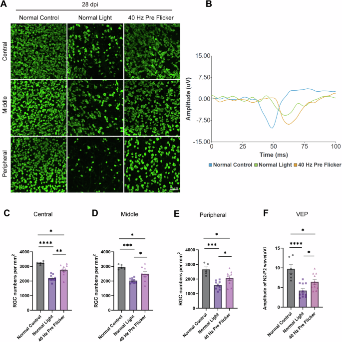 Fig. 3: Preconditioning with 40 Hz flicker provided significant protection at 4 weeks after NAION induction, corresponding to the late atrophy stage.