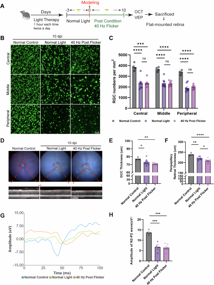 Fig. 4: 40 Hz post-ischemia conditioning did not rescue RGC loss or preserve retinal structure and function in the NAION model.