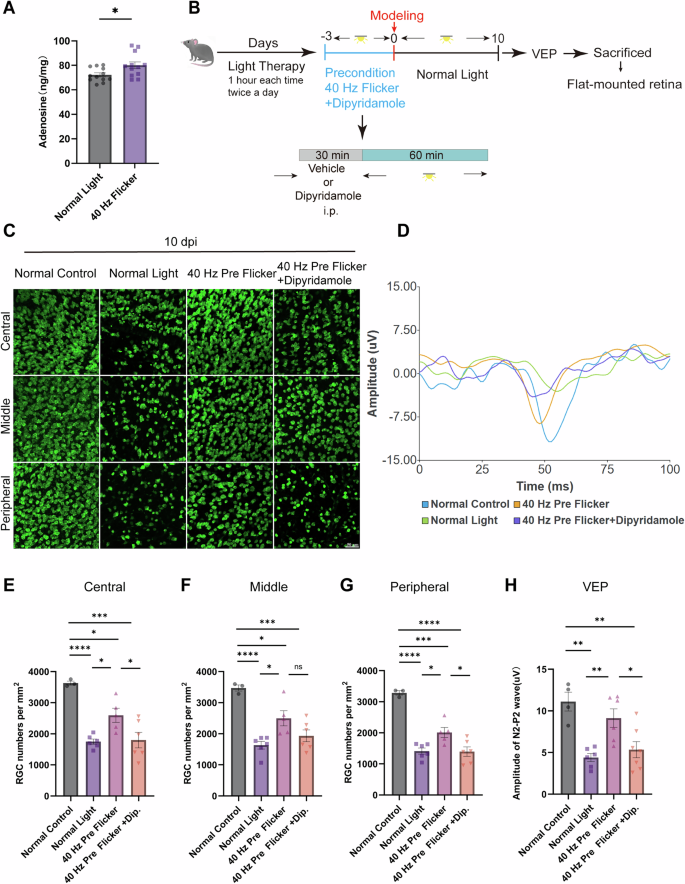 Fig. 6: 40 Hz flicker increased ocular adenosine levels, and the neuroprotective effect of 40 Hz flicker preconditioning was attenuated by dipyridamole.