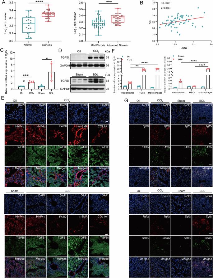 Fig. 1: TGFBI is significantly upregulated in nonparenchymal cells of fibrotic livers.