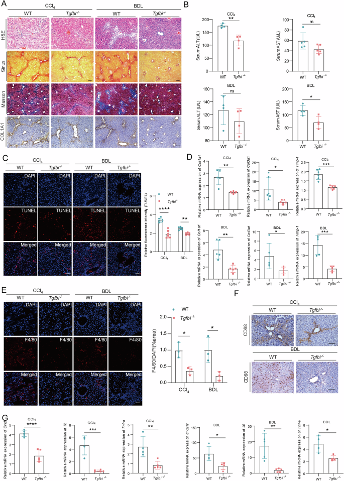 Fig. 2: TGFBI deficiency remarkably alleviates mice liver inflammation and fibrosis.
