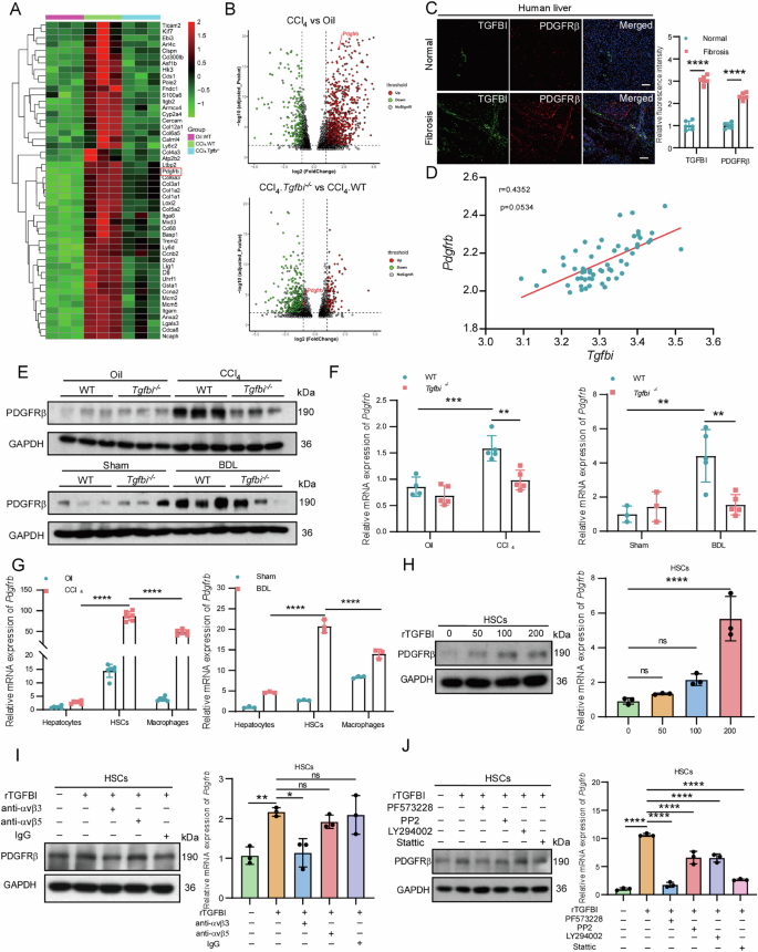 Fig. 4: TGFBI promotes HSC activation in a PDGFRβ dependent manner.