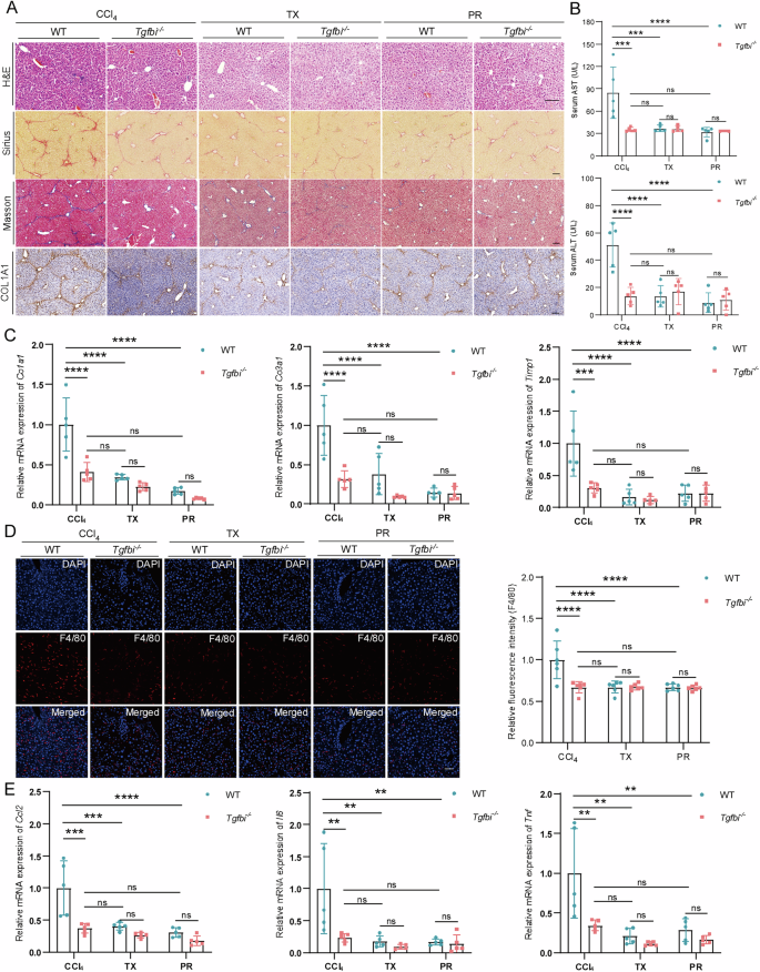 Fig. 7: Blocking PDGFRβ alleviates mouse liver inflammation and fibrosis.