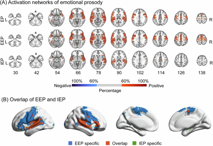 Fig. 1: The activation networks of emotional prosody based on overall cohort.