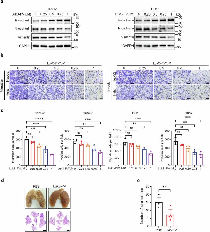 Fig. 1: LukS-PV inhibits EMT and metastatic progression in HCC.