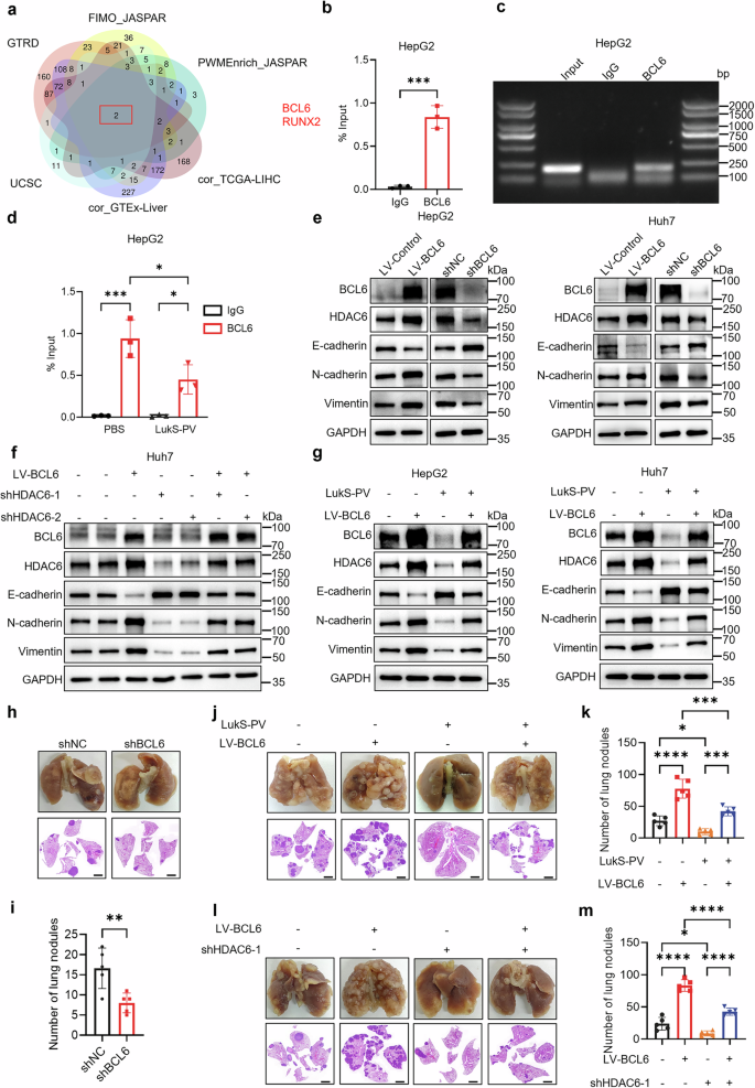 Fig. 4: LukS‑PV inhibits EMT in HCC by decreasing HDAC6 expression via BCL6 downregulation.