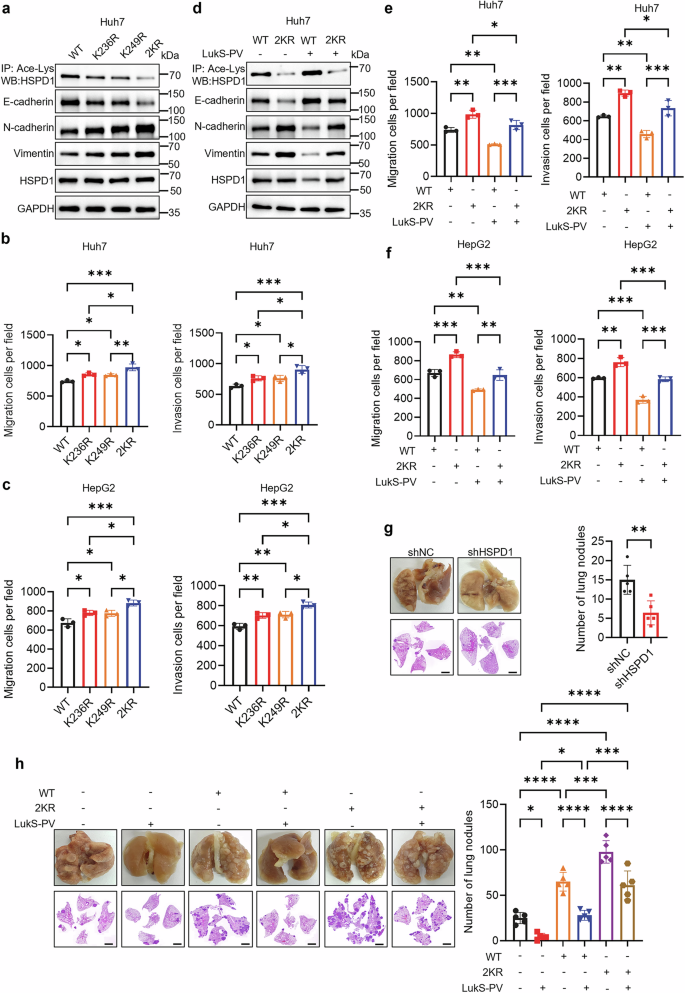 Fig. 7: Hypoacetylated HSPD1 displays enhanced EMT function in HCC.
