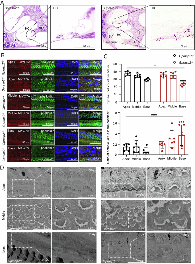 Fig. 2: The structure examination of the cochlea between Gprasp2-deficient mice and WT mice.