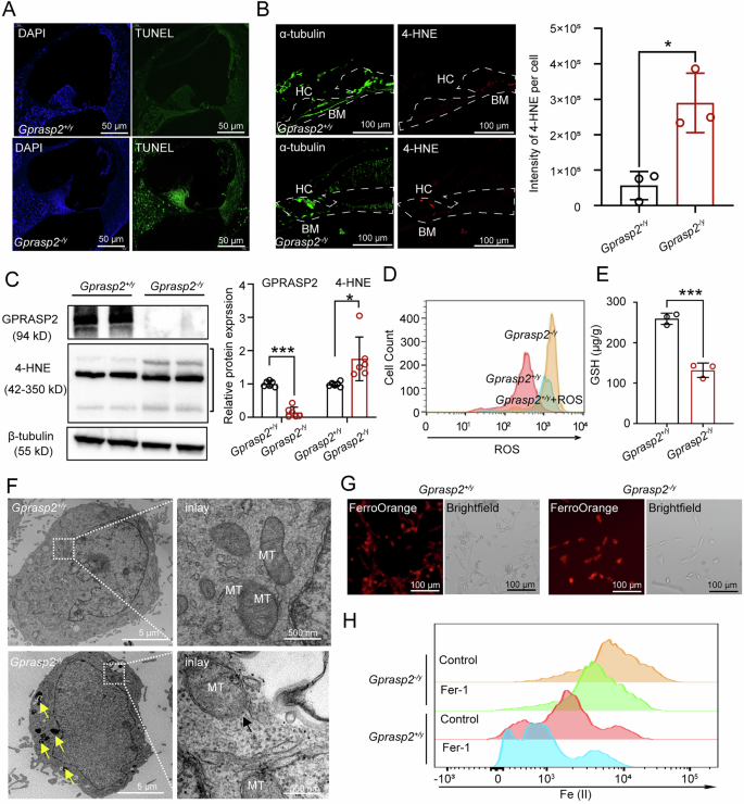 Fig. 3: Effect of Gprasp2-deficiency on ferroptosis in HEI-OC1 cells.