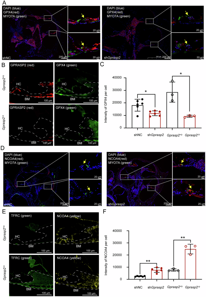 Fig. 5: The Gprasp2-deficiency enhances ferritinophagy in OHCs.