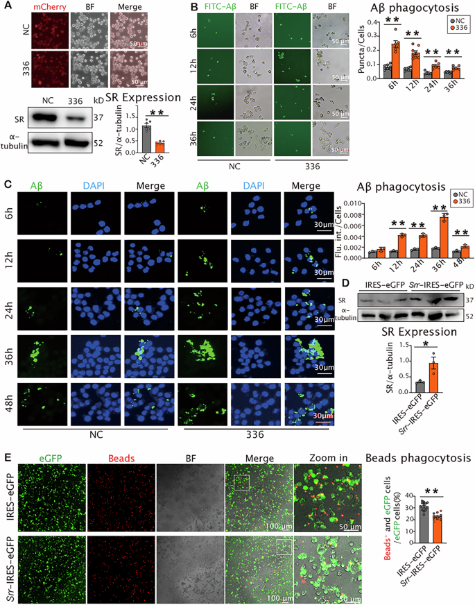 Fig. 1: Srr knockdown promoted Aβo phagocytosis in BV2 microglia, whereas SR overexpression exerted an inhibitory effect on phagocytic uptake of microbeads.