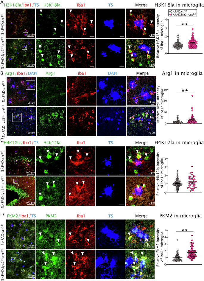 Fig. 6: Srr knockout in the microglia of 5×FAD mice markedly enhanced lactylation at histone H3K18 in microglia surrounding Aβ plaques in the dentate gyri.